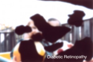 Diabetic Retinophathy Example